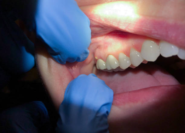 Best Broken or Chipped Tooth Repair in Oak Forest, IL